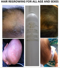 #1 SBS show( Medicine or Myth) tested Shampoo by Adama Kamara